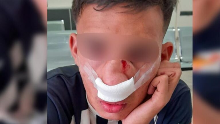Liga de Punilla: Terrible agresión contra un chico de 16 años en un partido de fútbol juvenil en La Calera
